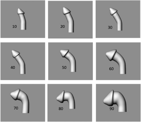 Penile curvature treatment options &mdash; Peyronie's disease