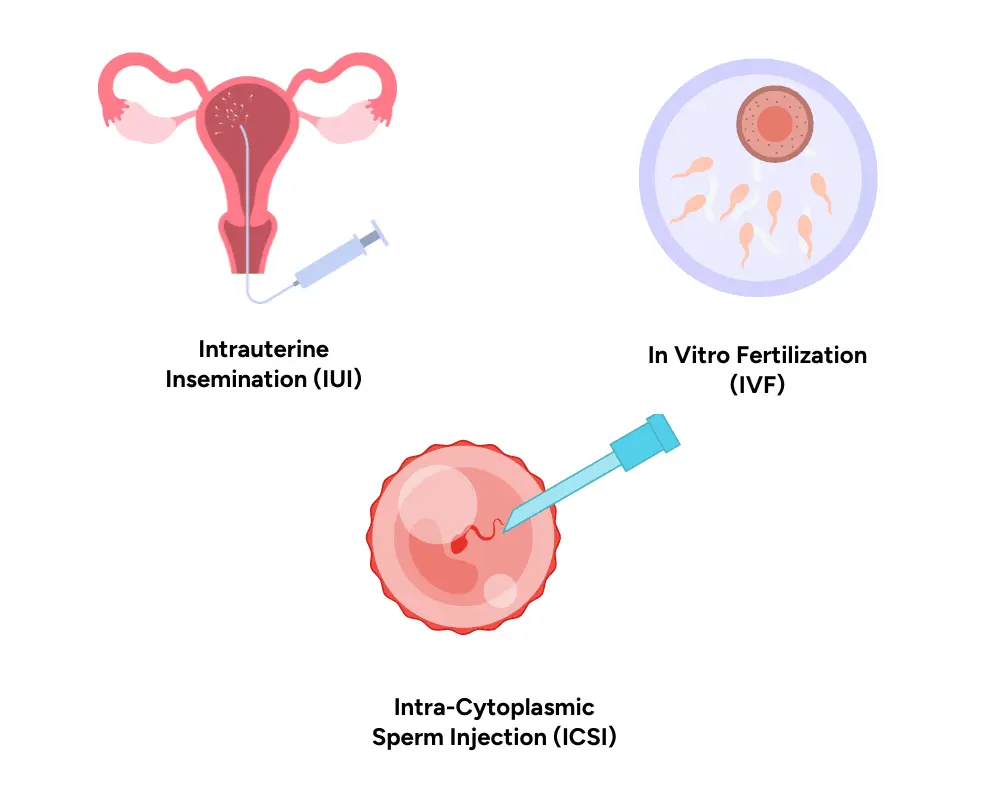 IUI, IVF and ICSI treatment