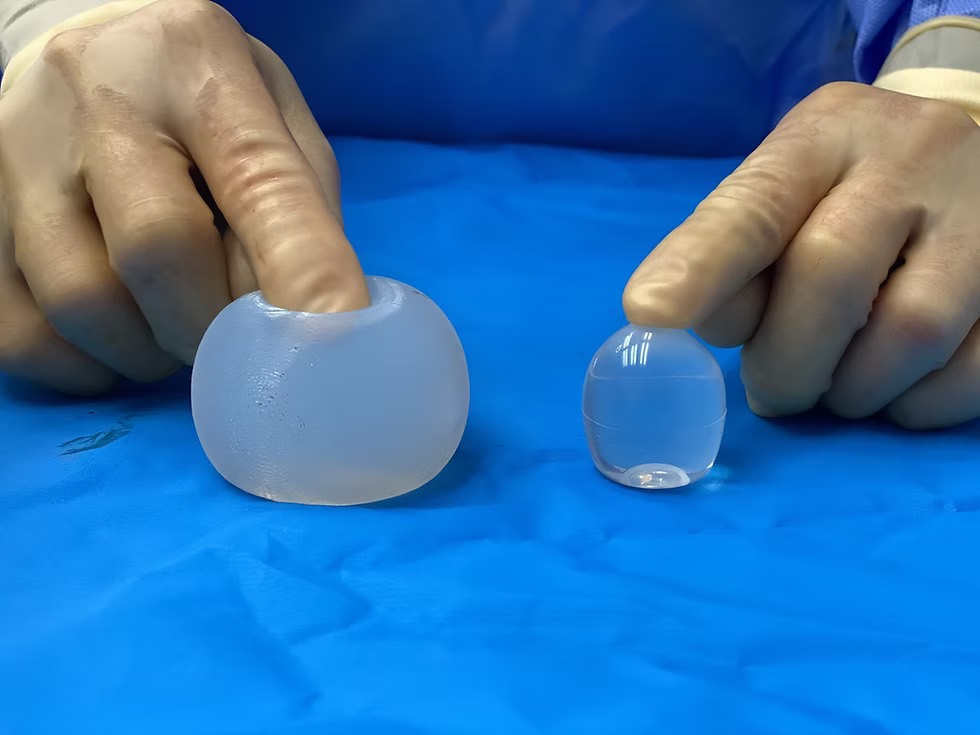 Two silicone testicular implants of different sizes on a surgical drape, held by a surgeon in theatre